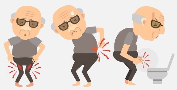 Symptoms and drug treatment of prostatitis